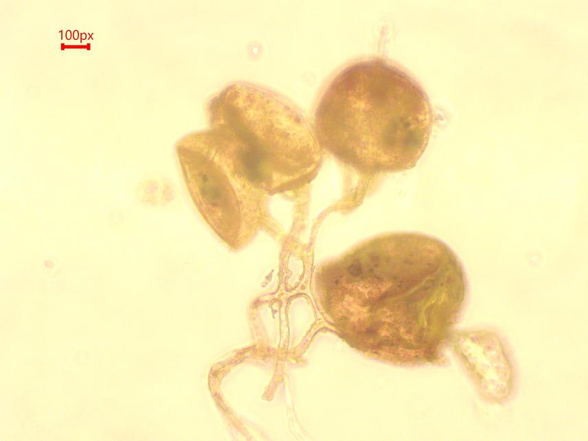 Rhizophagus aff. irregularis_sampled in the commune of Ouèssè in central Benin_Toui-Kilibo  forest reserve © Tchan Issifou Kassim